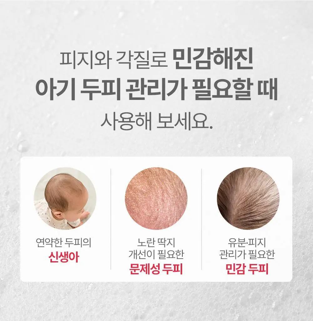 아토팜 뉴본 스칼프 샴푸 300ml 상세페이지 39