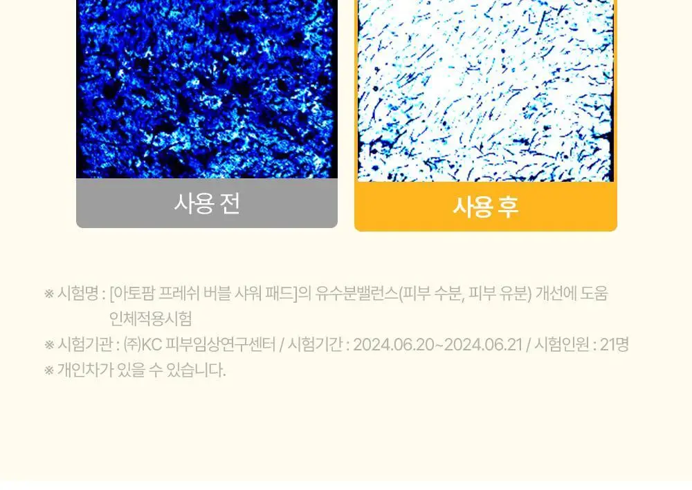 아토팜 키즈 프레쉬 버블 샤워 패드 10.4g (5개입) 상세페이지 42
