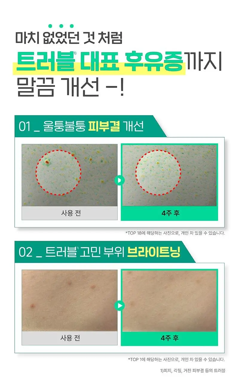 일리윤 시카 아크네 바디워시 400ML 상세페이지 11