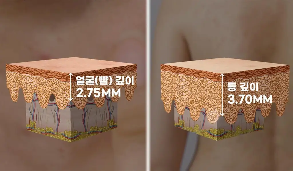 메디큐브 레드 클리어 시카 바디미스트 200ml 상세페이지 7