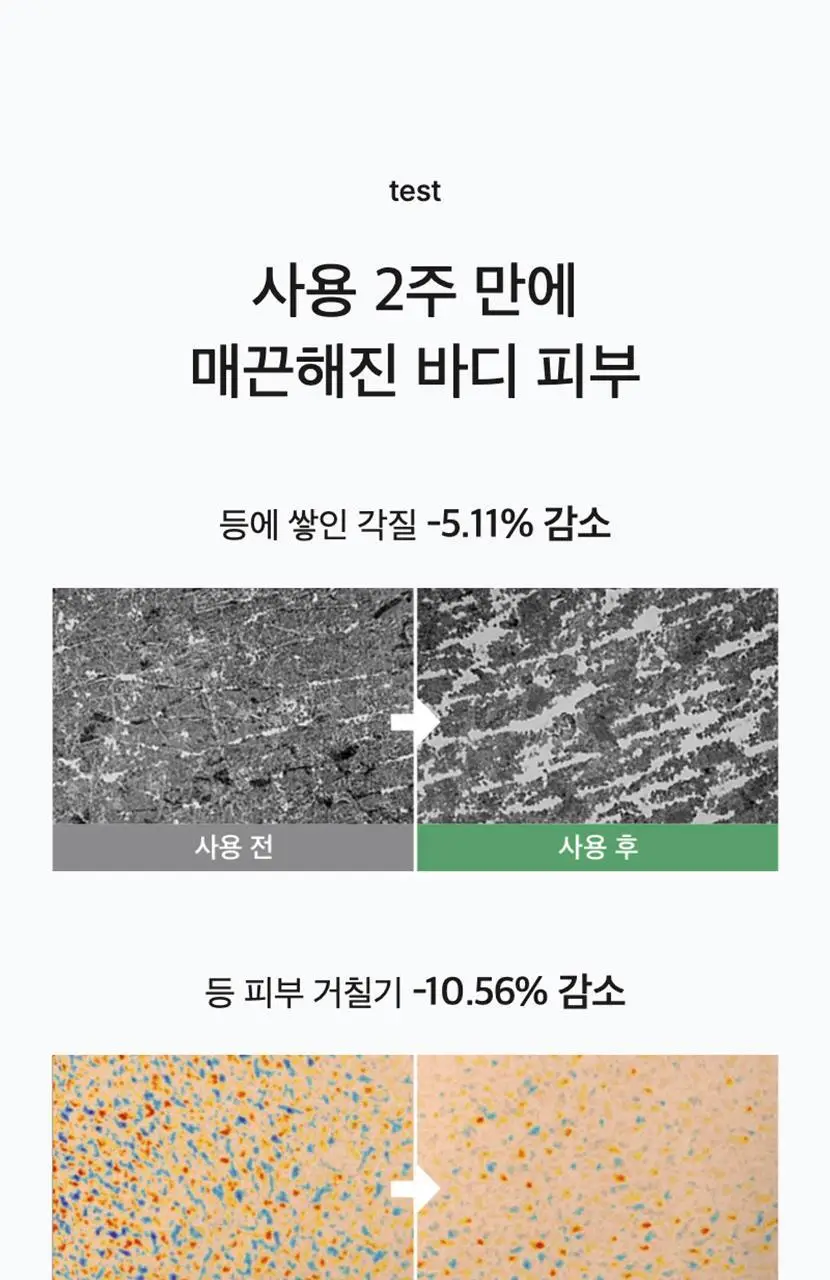 셀리맥스 지우개 어성초 바하 바디 미스트 150ml 상세페이지 4