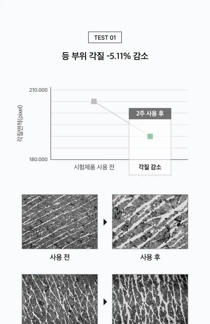 셀리맥스 지우개 어성초 바하 바디 미스트 150ml 상세페이지 10