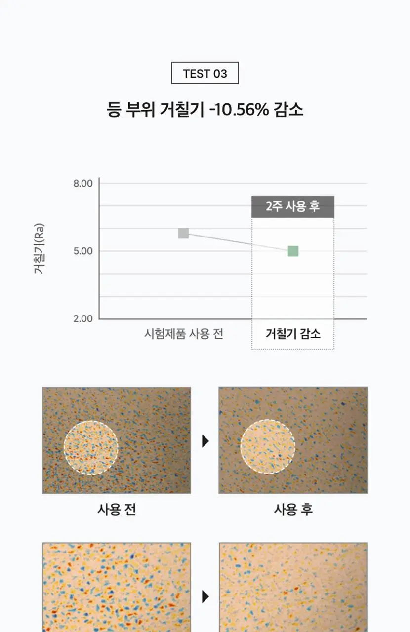 셀리맥스 지우개 어성초 바하 바디 미스트 150ml 상세페이지 13