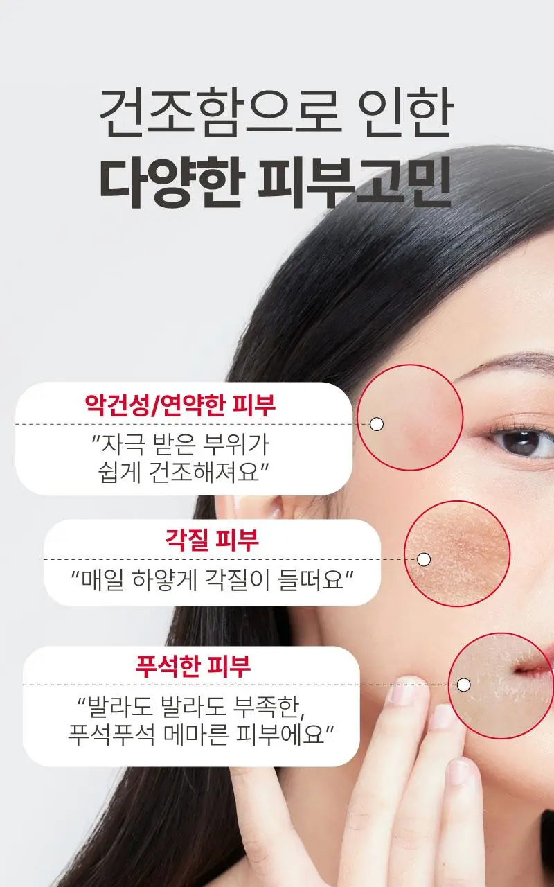 일리윤 MD 레드이치 오일 200ML 기획 (+크림 30ML 증정) 상세페이지 9