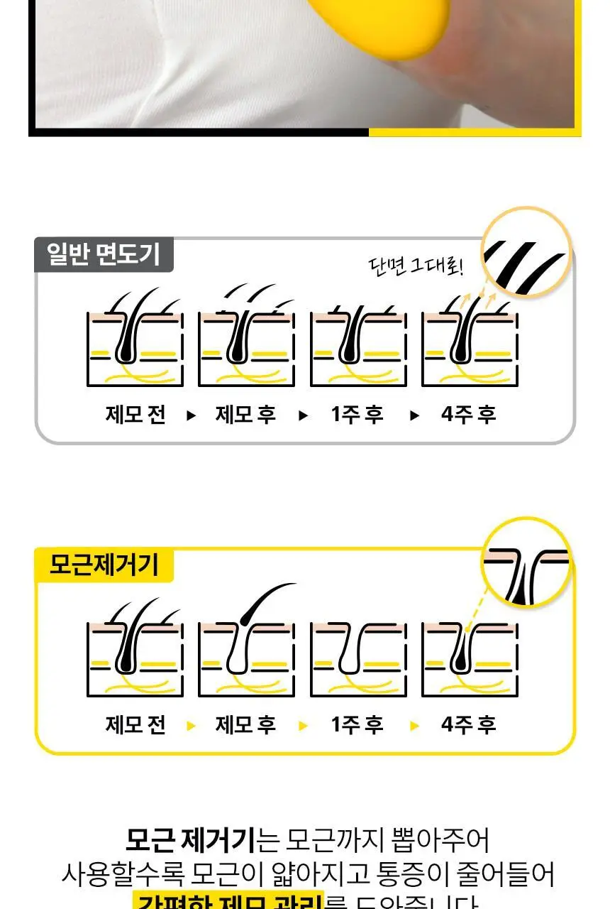 고릴라왁싱 제로페인 국소부위 휴대용 미니 모근제거기 바디트리머 1000V 상세페이지 7