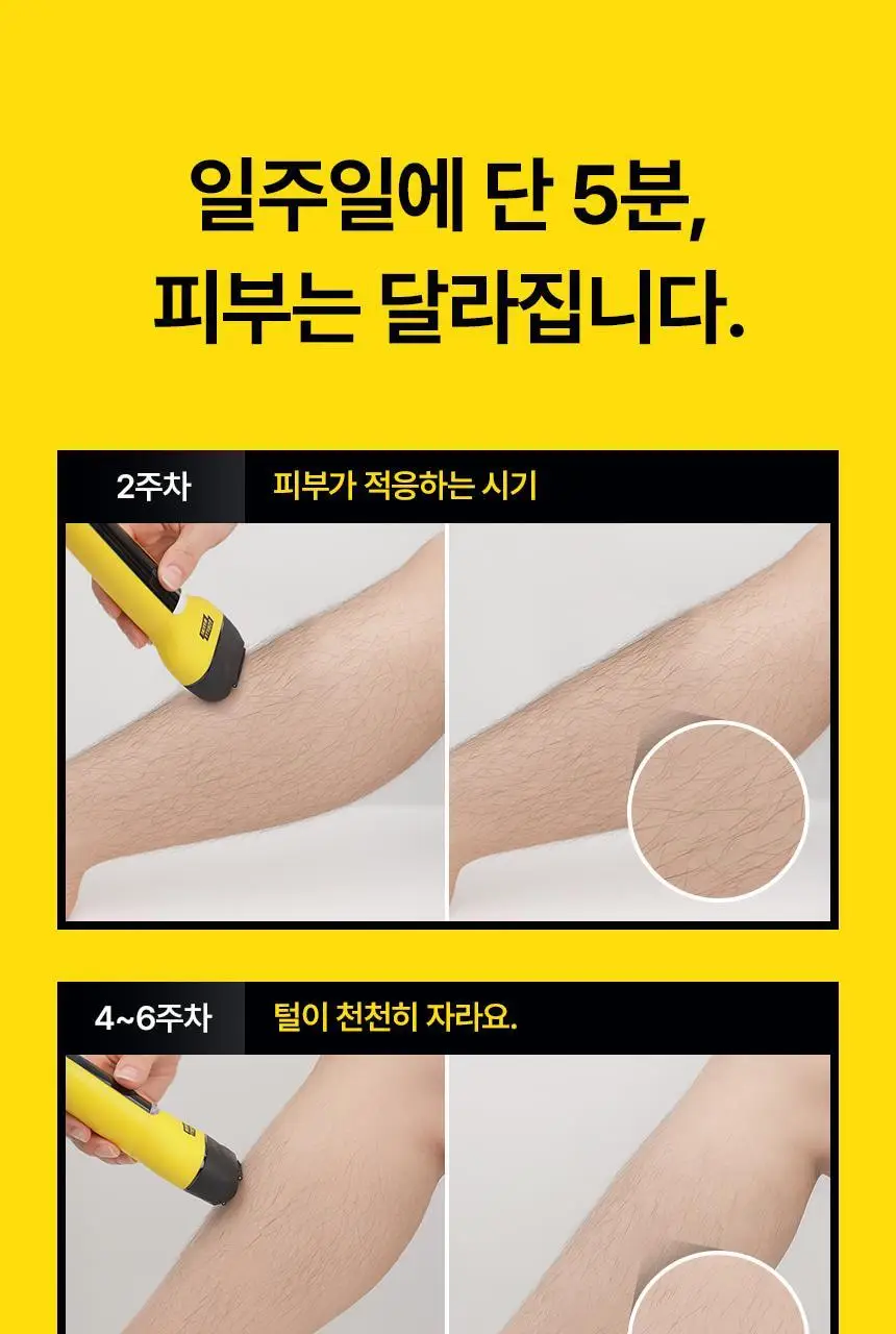 고릴라왁싱 3in1 멀티 모근제거기 바디트리머 2000V 상세페이지 30