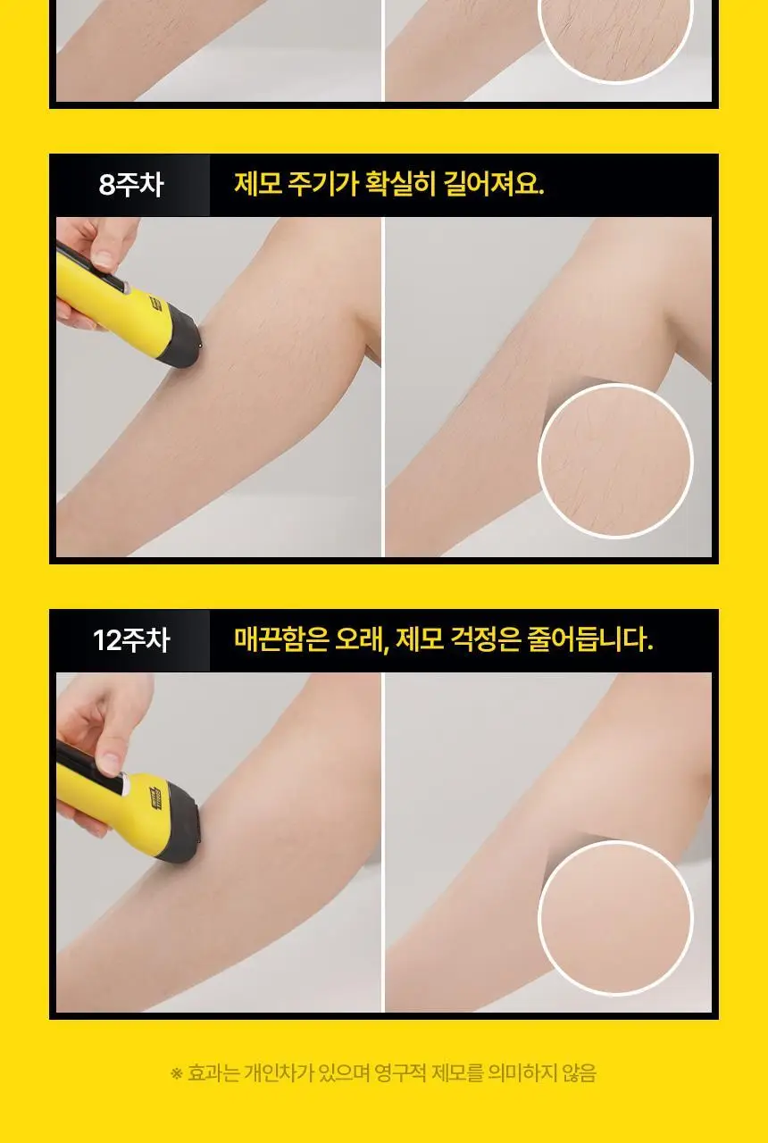 고릴라왁싱 3in1 멀티 모근제거기 바디트리머 2000V 상세페이지 31