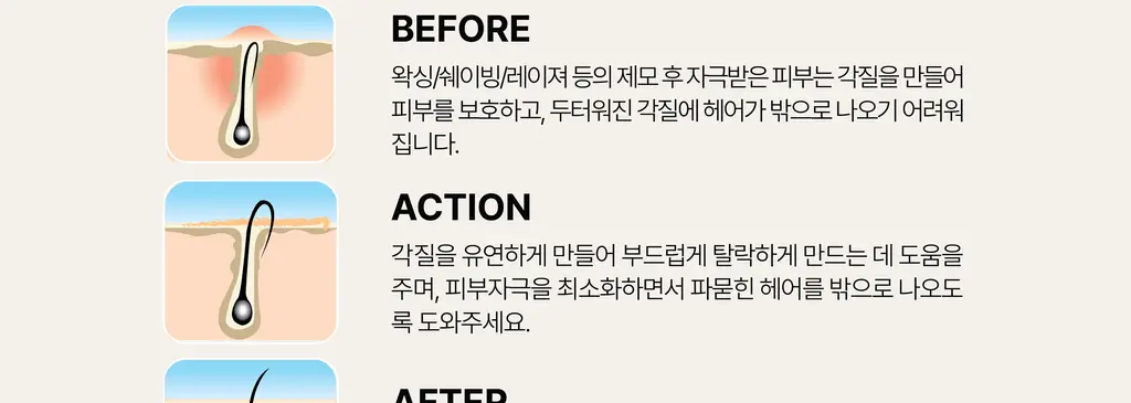 라이콘 인그로운 엑스잇(X-IT) 솔루션 2종 (50ml / 125ml) 상세페이지 15