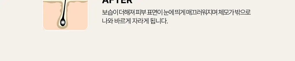 라이콘 인그로운 엑스잇(X-IT) 솔루션 2종 (50ml / 125ml) 상세페이지 16