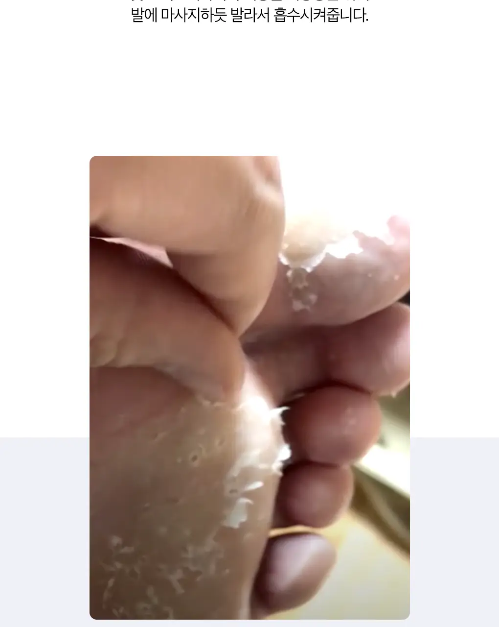 닥터원더 발 각질제거 악어발팩 상세페이지 13