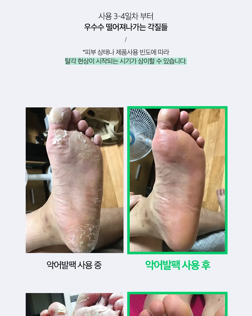 닥터원더 발 각질제거 악어발팩 상세페이지 14