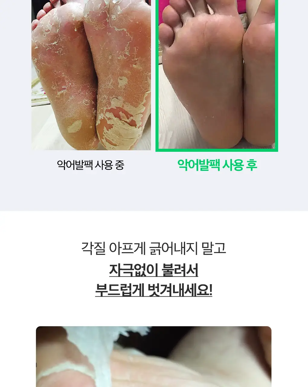 닥터원더 발 각질제거 악어발팩 상세페이지 15