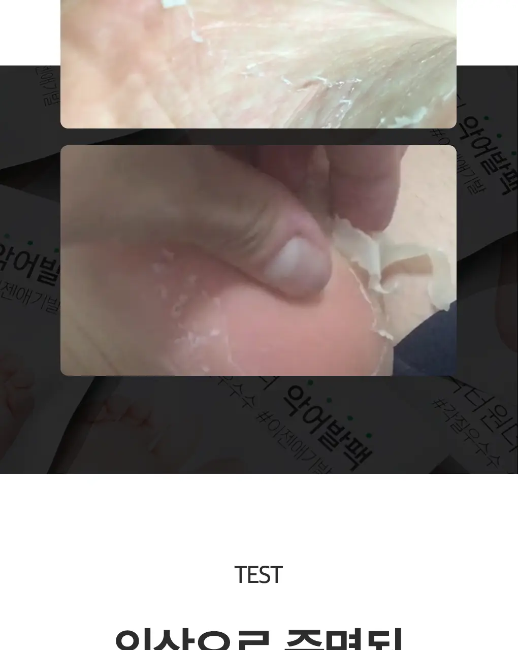 닥터원더 발 각질제거 악어발팩 상세페이지 16