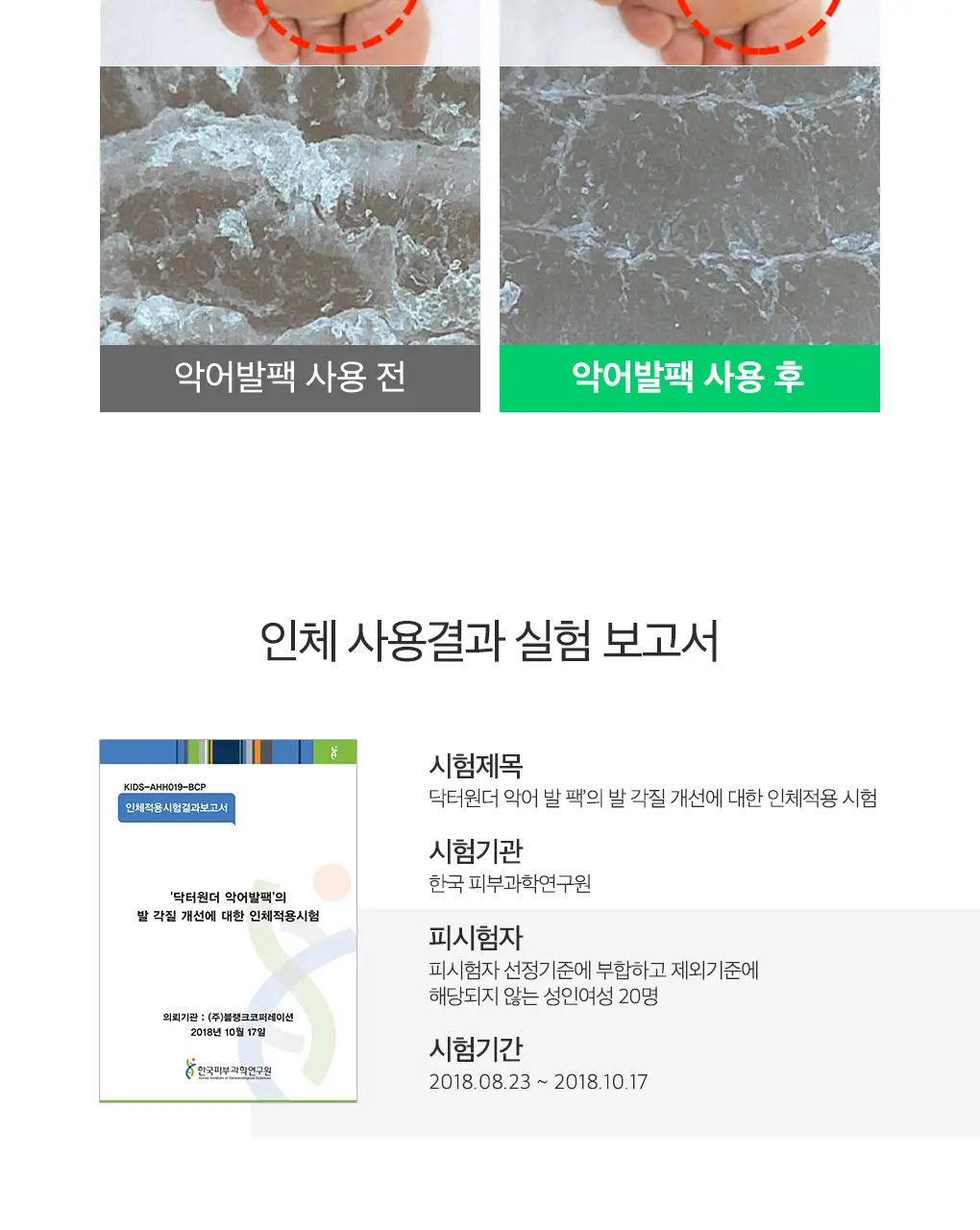 닥터원더 발 각질제거 악어발팩 상세페이지 19