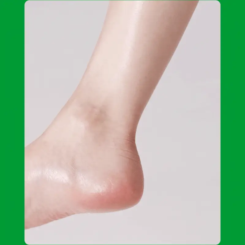 닥터원더 악어꿈치팩 1매 상세페이지 15