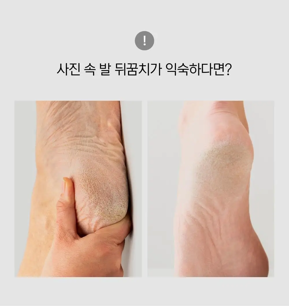 닥터원더 악어꿈치팩 1매 상세페이지 21