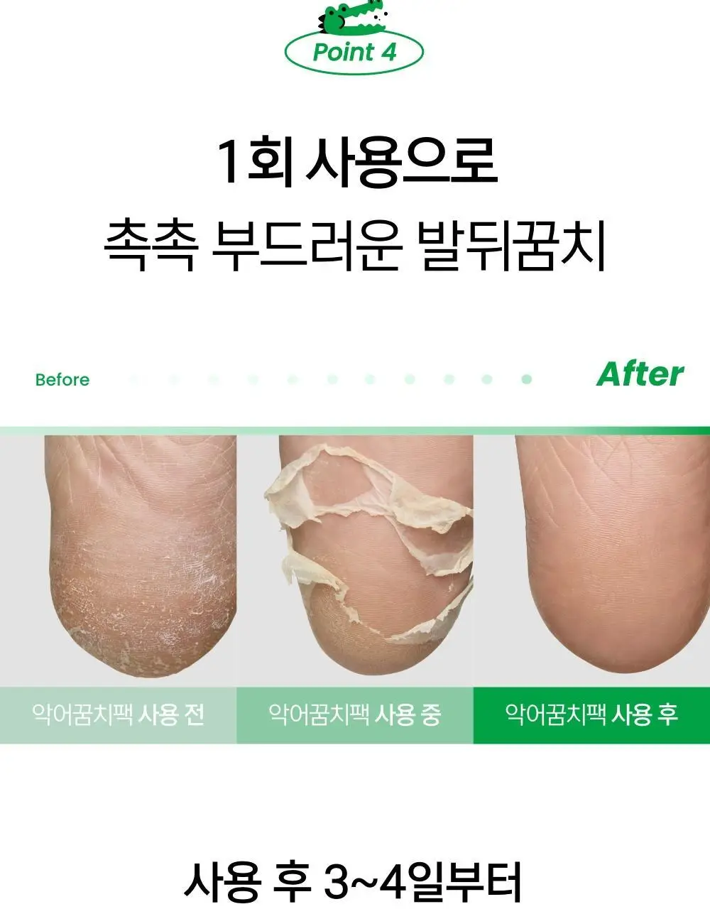 닥터원더 악어꿈치팩 1매 상세페이지 27