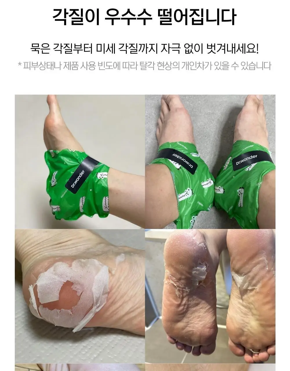 닥터원더 악어꿈치팩 1매 상세페이지 28