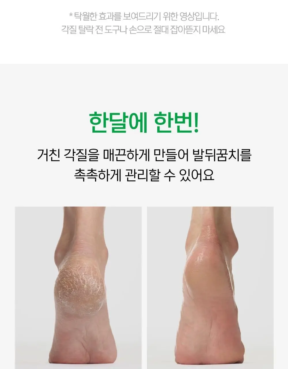 닥터원더 악어꿈치팩 1매 상세페이지 31