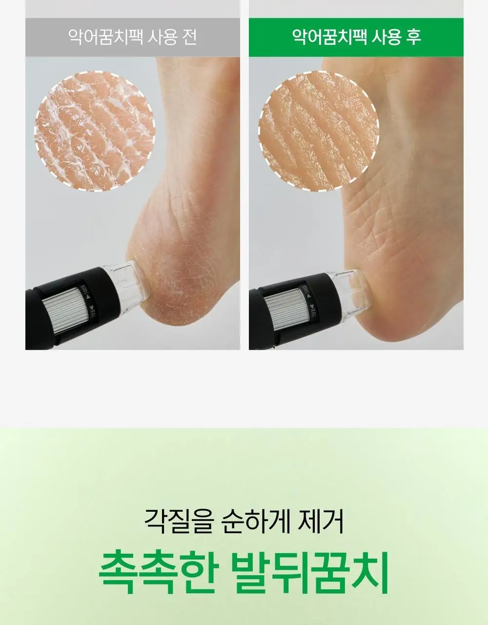 닥터원더 악어꿈치팩 1매 상세페이지 32