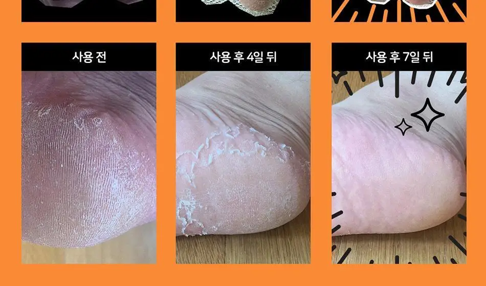 마데카 발필링팩 상세페이지 9