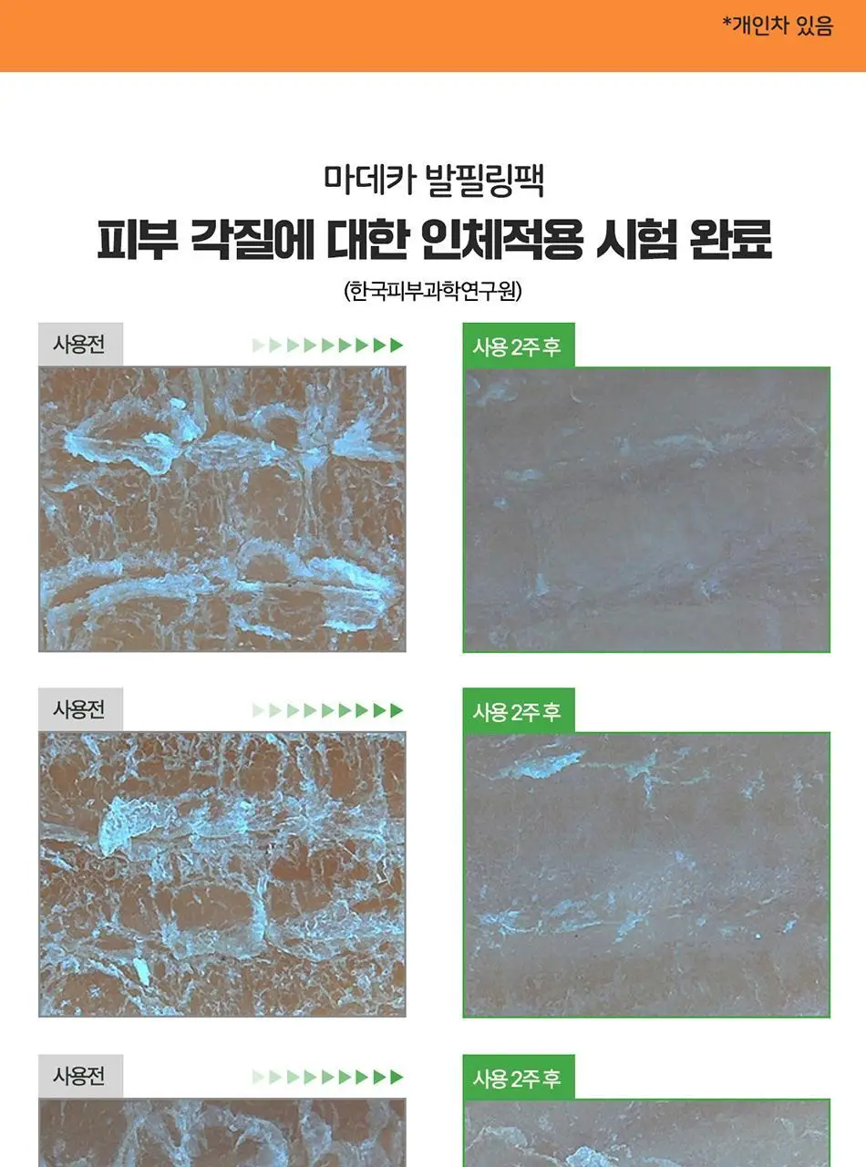마데카 발필링팩 상세페이지 11