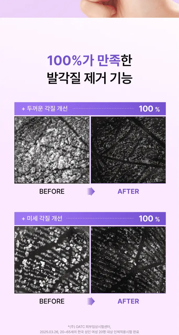 바렌 발각질지우개 홈세트 (미스트 120ml +풋파일) 상세페이지 20