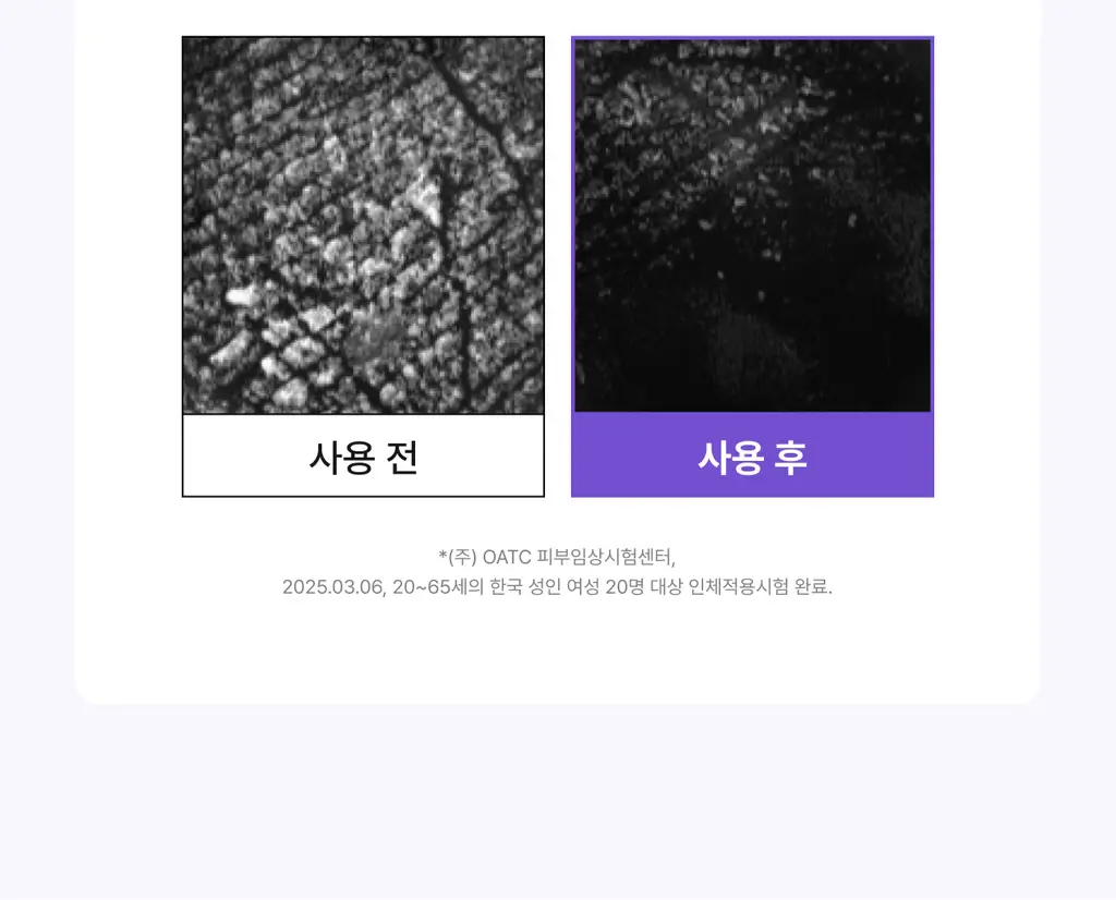 바렌 시어버터 슬리핑 힐 패치 6매입 상세페이지 24