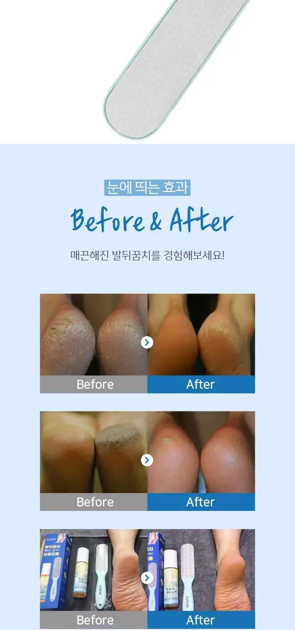 소프리스 발뒤꿈치 뿌리고 밀어서 보들보들 (풋 필링미스트 100ml+풋파일) 상세페이지 13