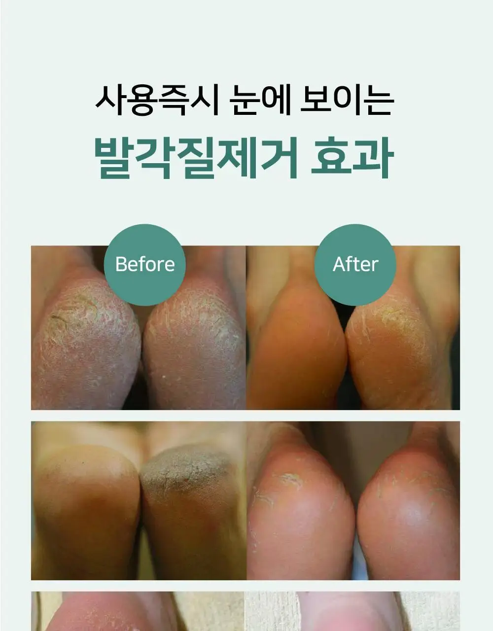 소프리스 풋 필링 미스트 100ml 상세페이지 4