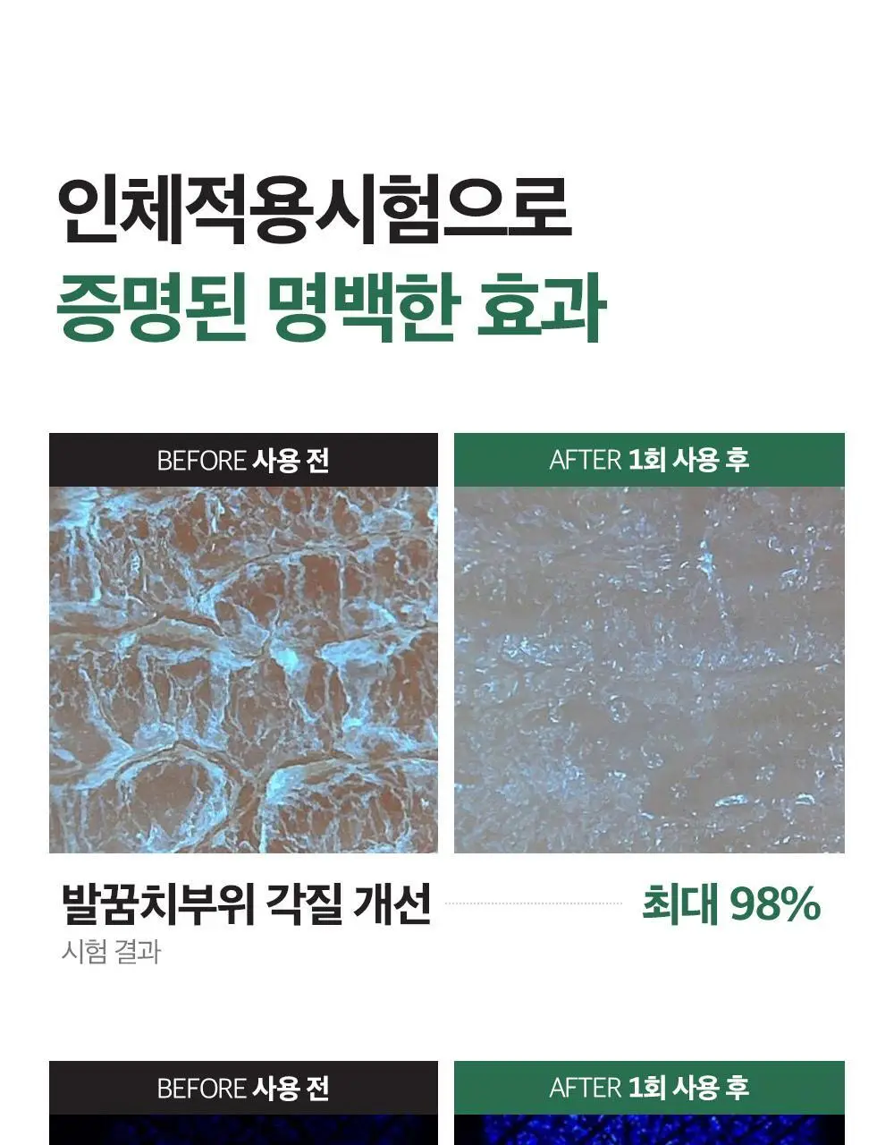 에슬라이트 어성초 필리프 풋 패치 8매 상세페이지 6