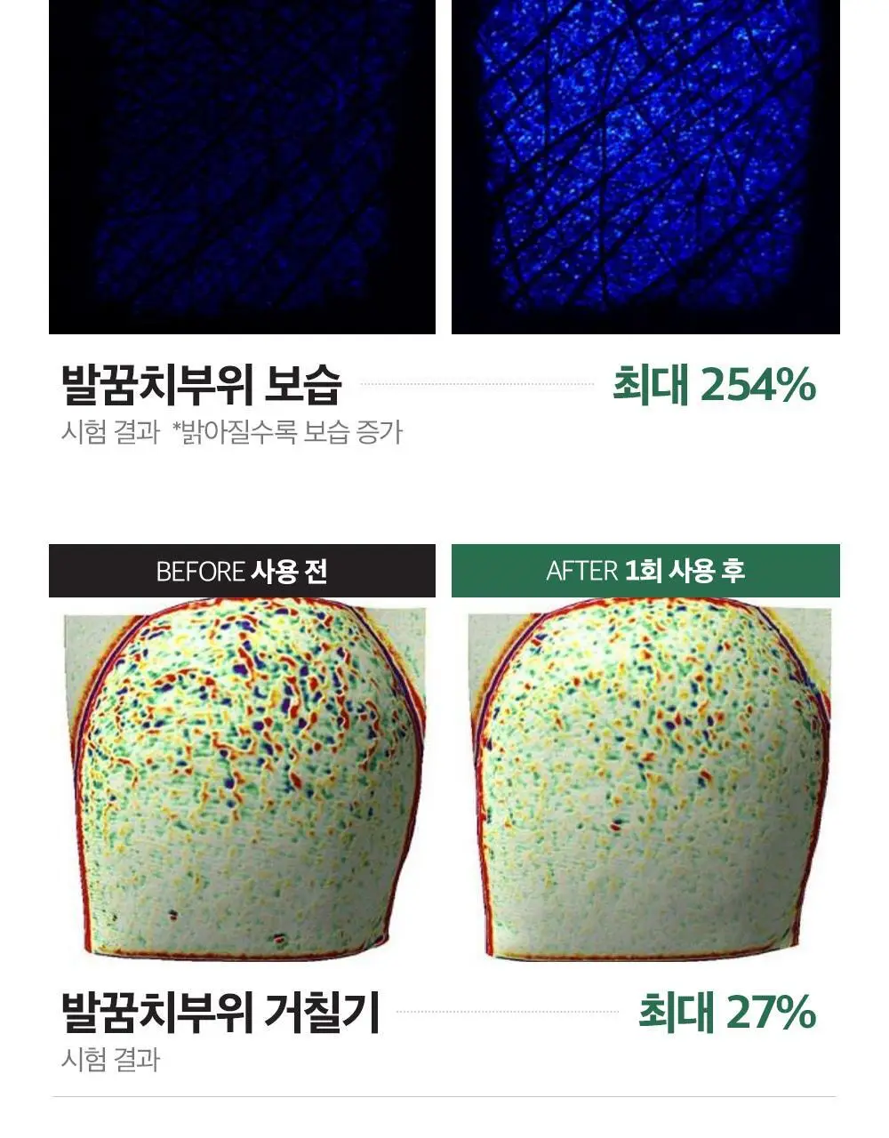 에슬라이트 어성초 필리프 풋 패치 8매 상세페이지 7