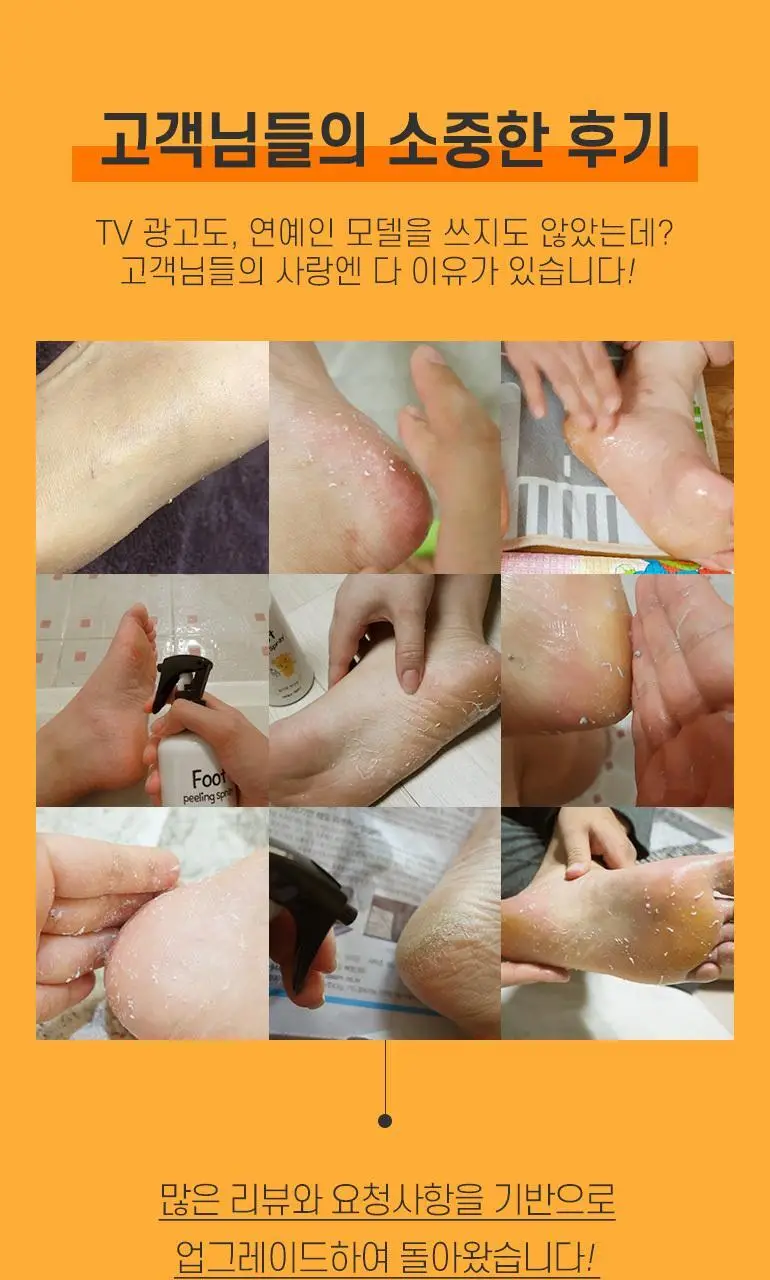 역대급 발각질 제거제 200ml 상세페이지 3