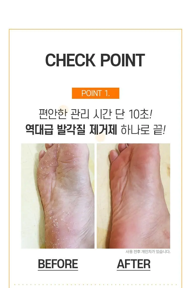 역대급 발각질 제거제 200ml 상세페이지 8