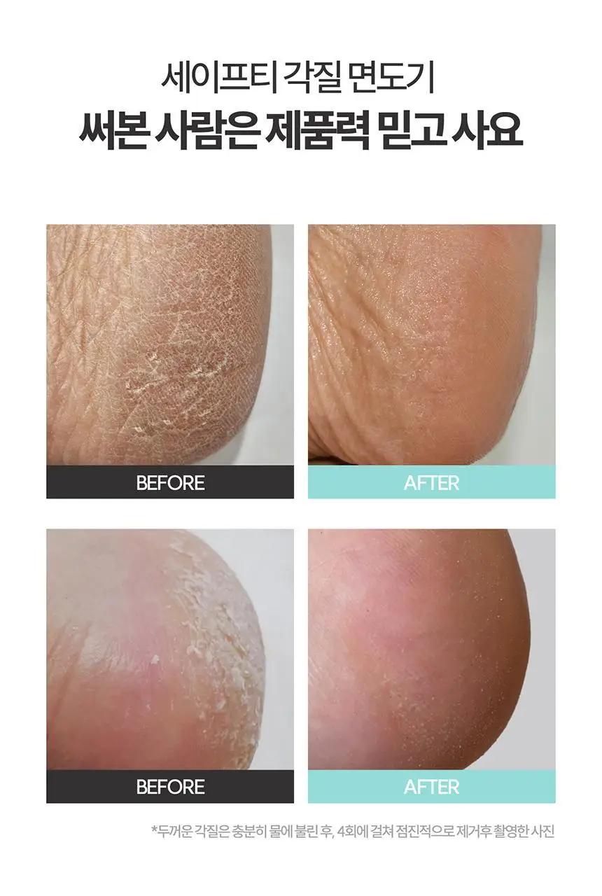 F3 세이프티 각질면도기 상세페이지 12