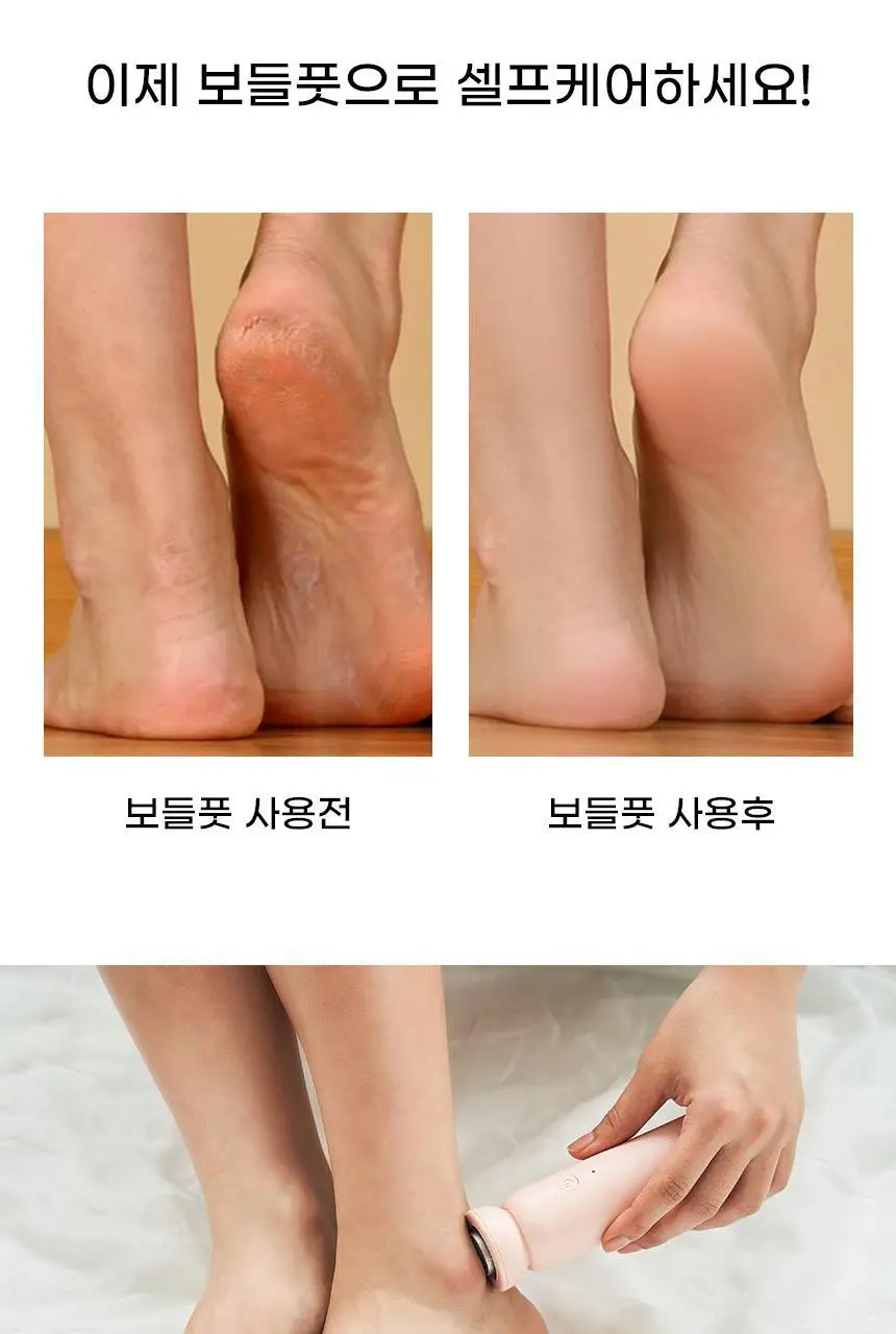 단미 충전식 전동 발 각질 제거기 DA-FGR01 2종 택 1 (화이트/핑크) 상세페이지 10