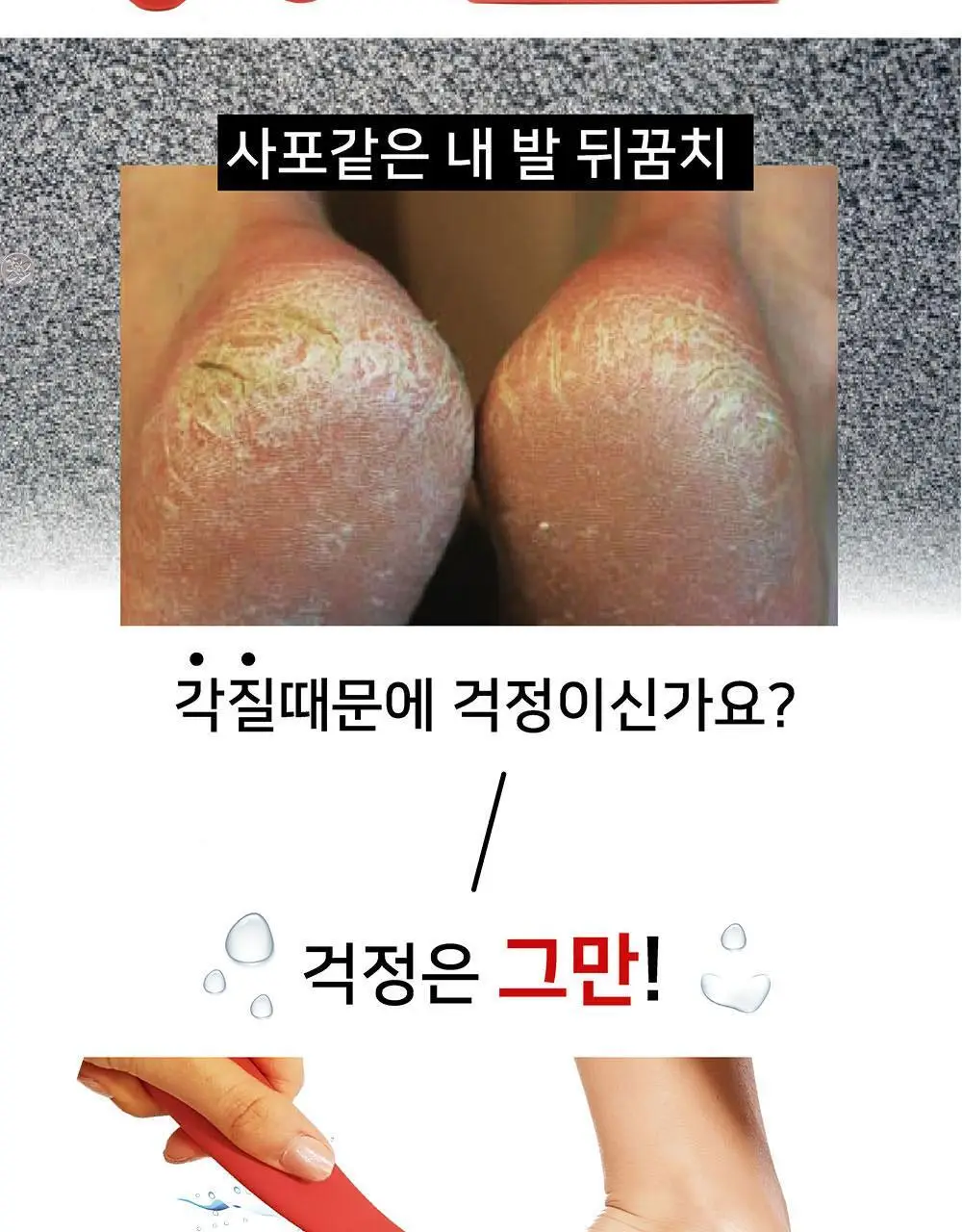 소프리스 트리플 풋파일 타원형 상세페이지 2