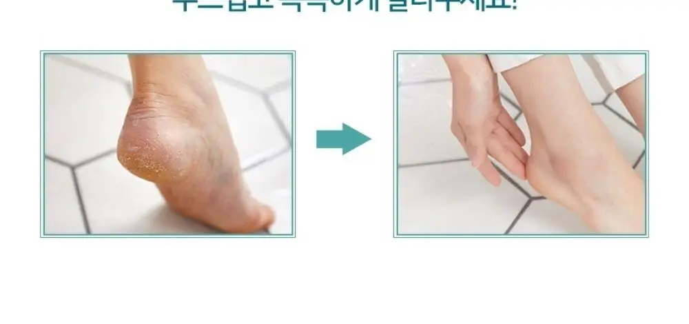 (풋크림 증정)온더바디 발을씻자 코튼 풋샴푸 510ml 트리플 기획 2종 택1(레몬/자몽) 상세페이지 49