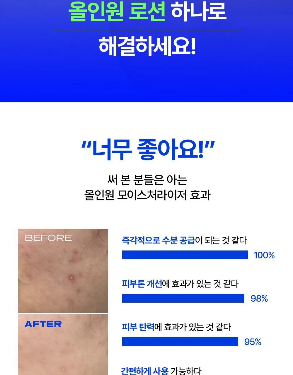 그라운드랩 올인원 모이스처라이저 스킨 로션 200ml 상세페이지 5
