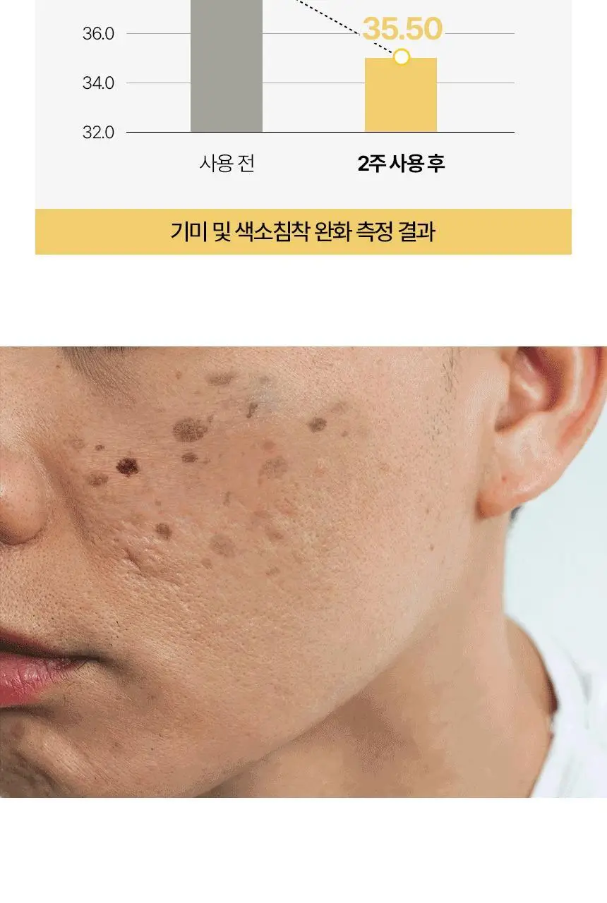 미프 비타맥스 올인원 로션 리필 세트 기획 (본품 200ml+리필 150ml*2ea) 상세페이지 9