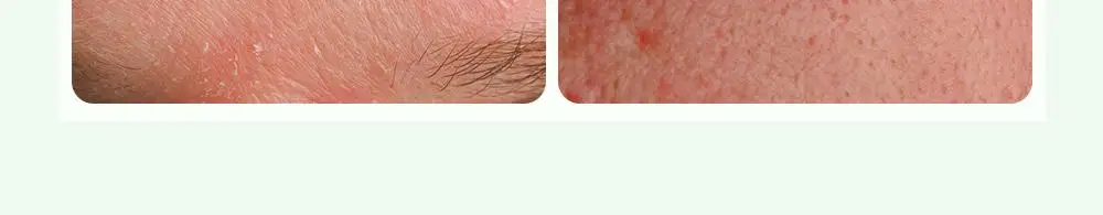 보나쥬르 퓨어마일드 맨 올인원 모이스쳐라이저 120ml 상세페이지 12