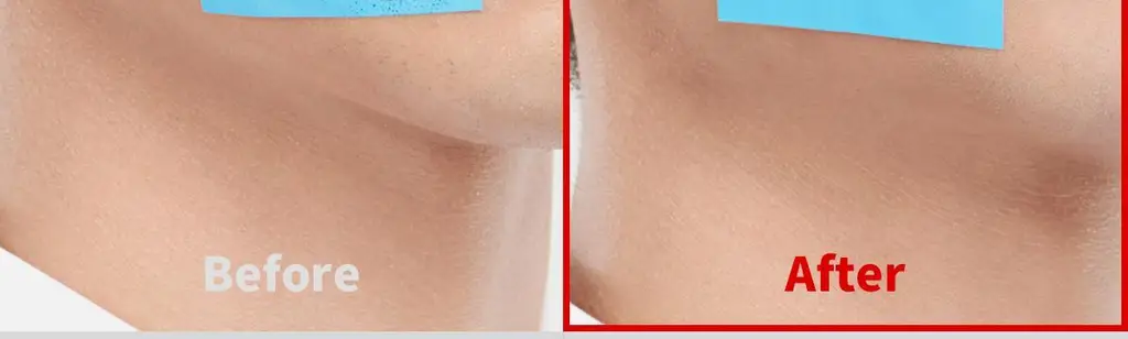포맨트 시그니처 올인원 에센스 96ml 상세페이지 20