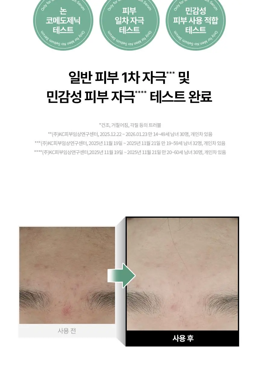 AHC 프로샷 온리 포맨 노세범 트러블 올인원 기획(120ml+120ml) 상세페이지 11