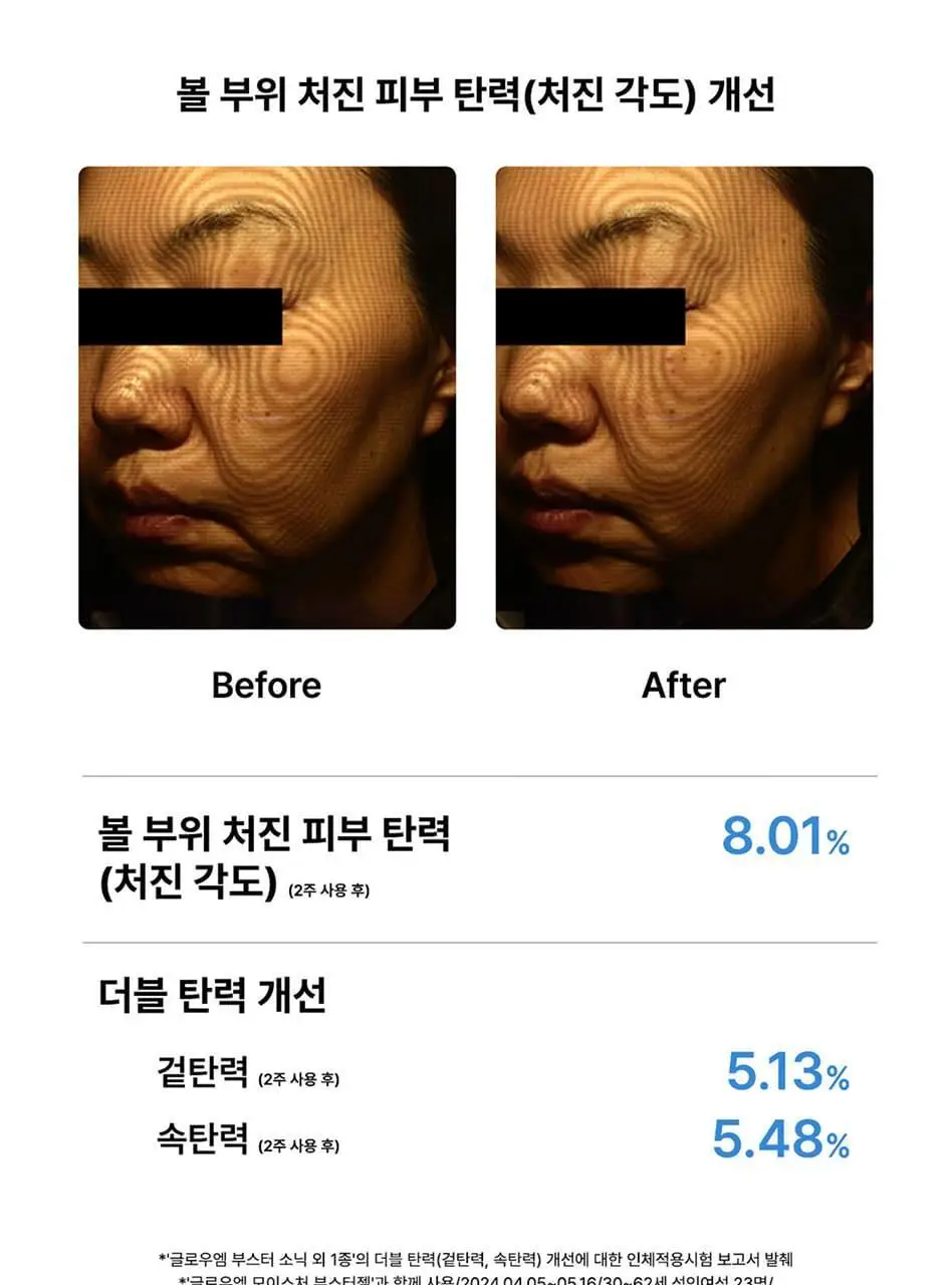 글로우엠 부스터 소닉 상세페이지 19