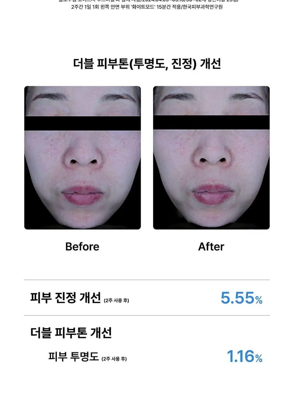 글로우엠 부스터 소닉 상세페이지 20