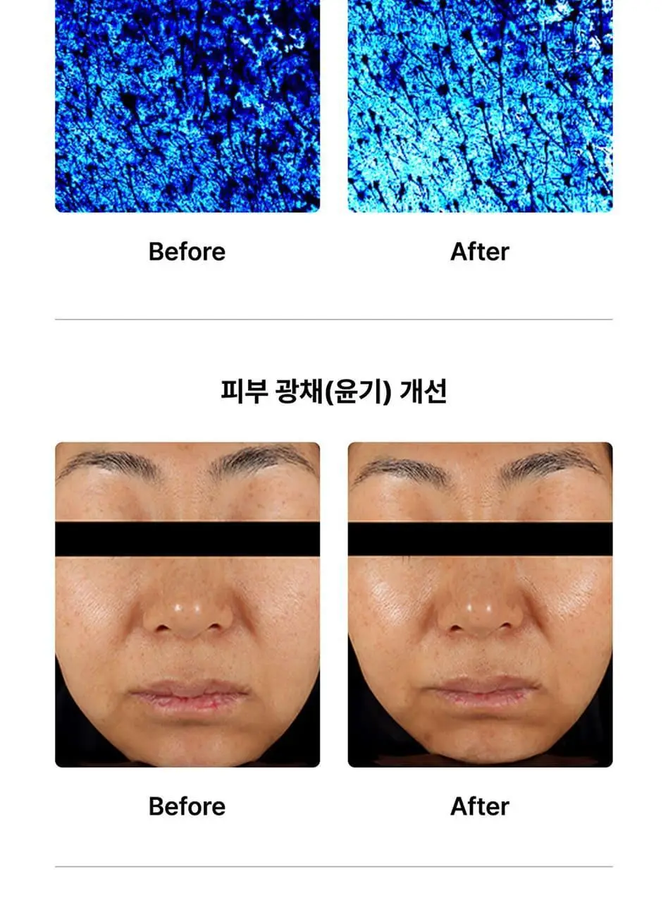 글로우엠 부스터 소닉 상세페이지 22