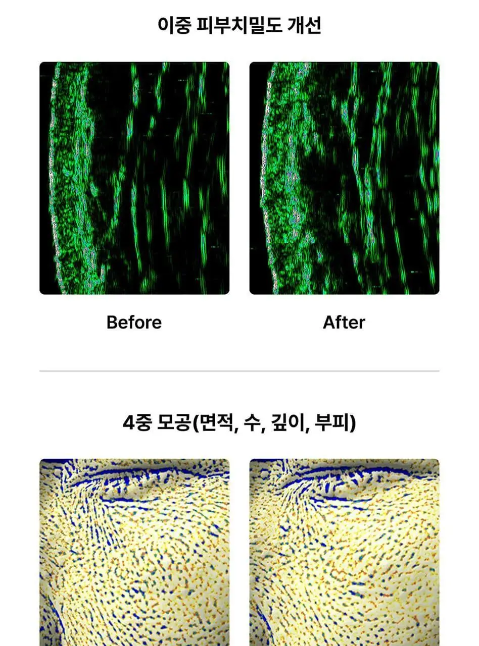 글로우엠 부스터 소닉 상세페이지 23