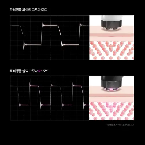 닥터탱글 고주파 마사지기 블랙 에디션 상세페이지 14
