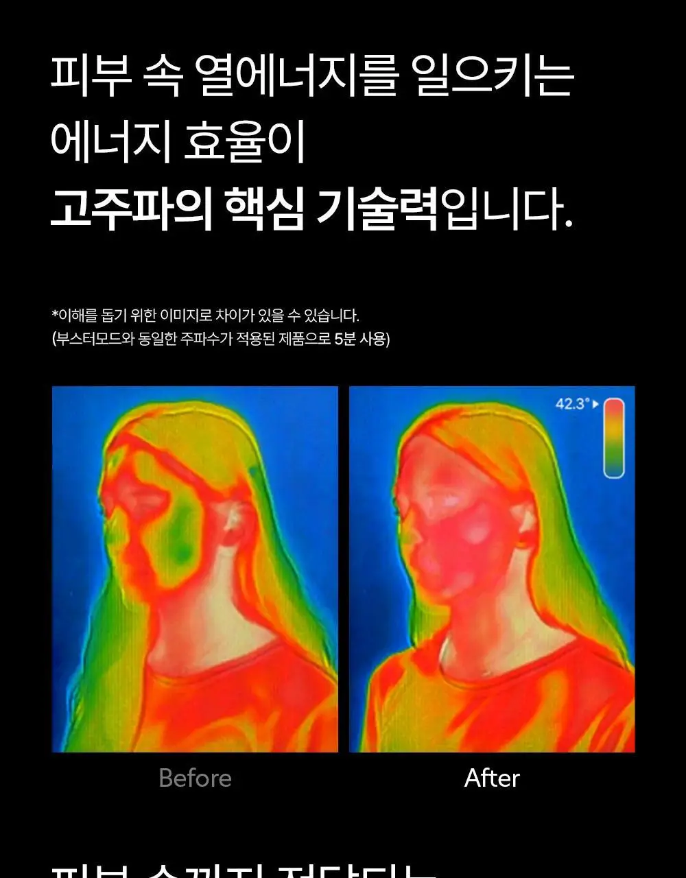 닥터탱글 고주파 마사지기 블랙 에디션 상세페이지 23