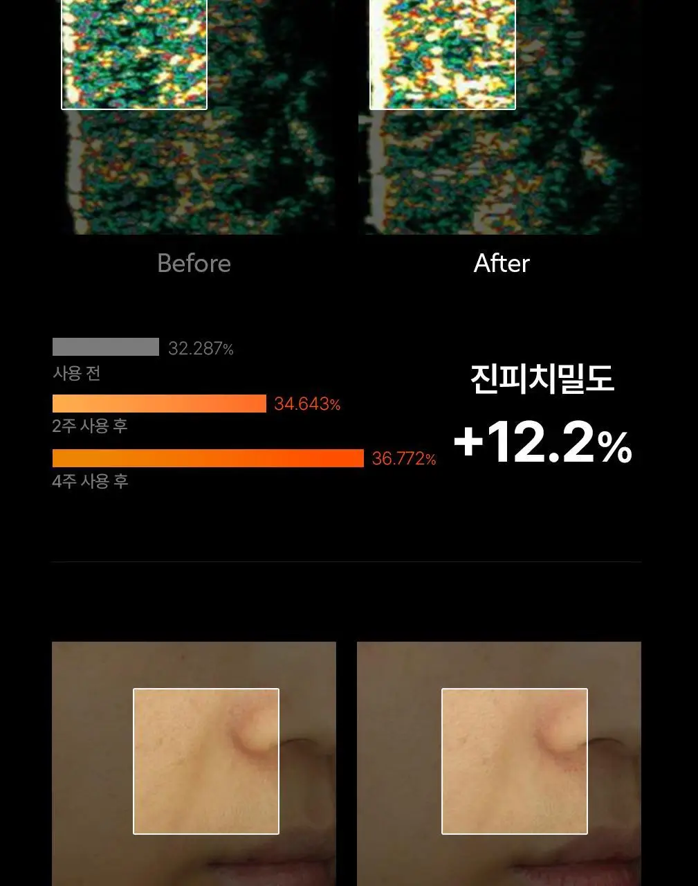 닥터탱글 고주파 마사지기 블랙 에디션 상세페이지 36